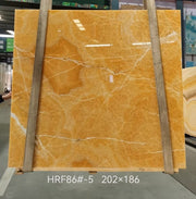 Cẩm Thạch Hồng Onyx, Thạch Cao Tuyết Hoa Kiểu Cột, Tấm Ốp Tường Nhân Tạo Hiện Đại, Gạch Lát Biệt Thự Chiếu Sáng Nền, Tấm Sàn 1mm Bề Mặt Đánh Bóng, Tấm Lớn